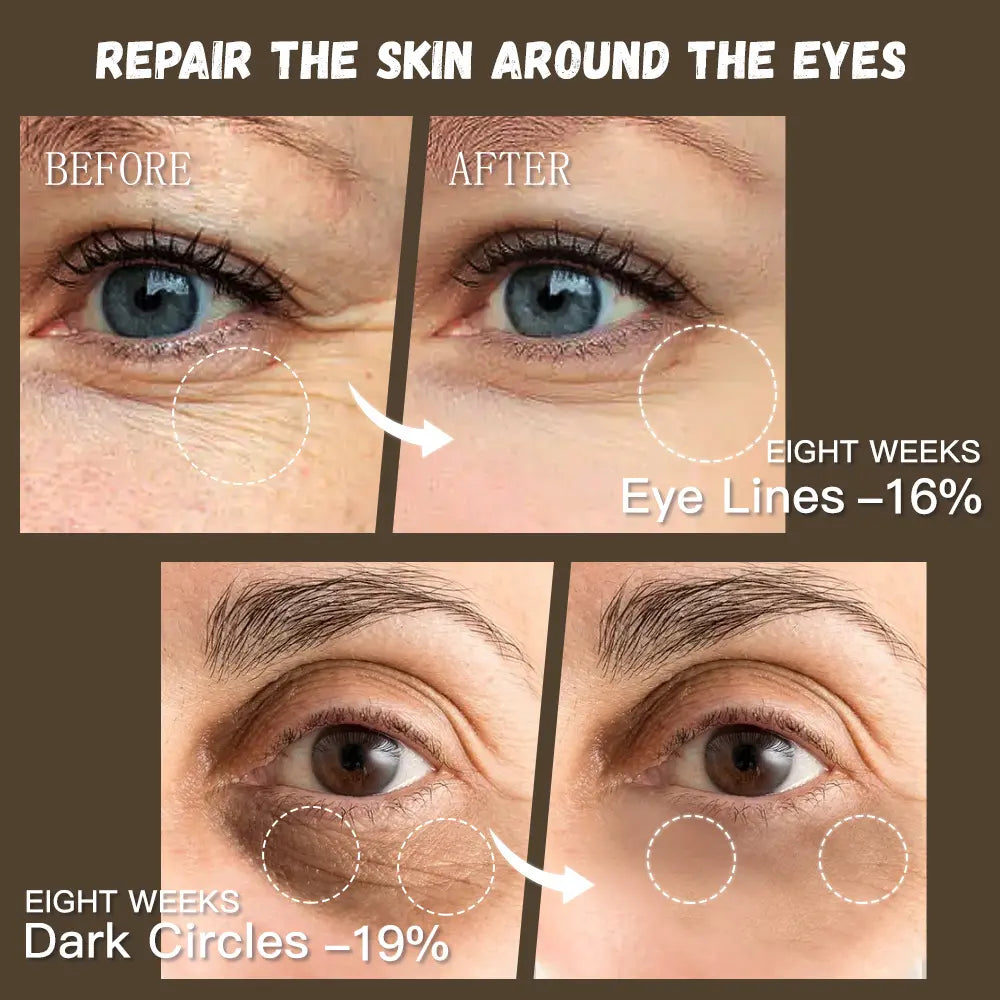 Before and after comparison of eye skin repair with text indicating results on a brown background.