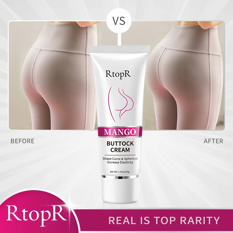 RtopR Mango Buttock Cream packaging with 'Before' and 'After' effects on skin.